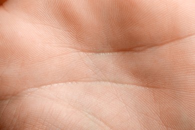 Closeup view of human hand with dry skin