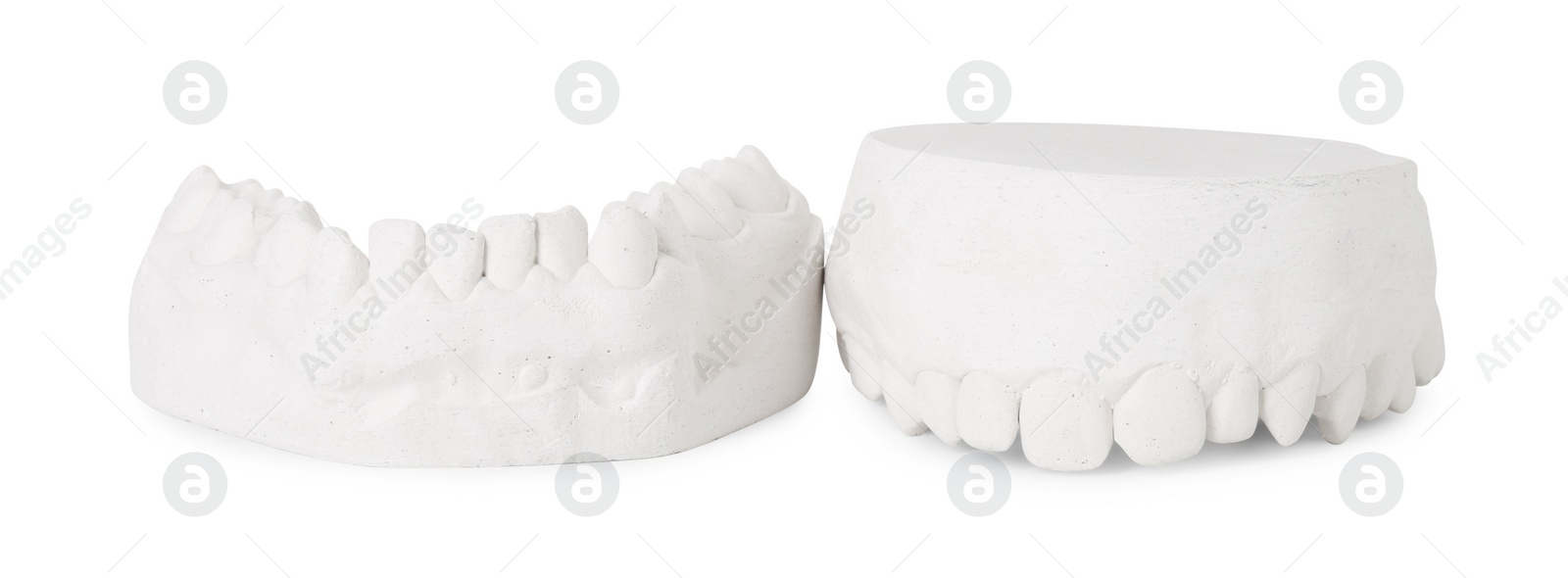 Photo of Dental model with gums isolated on white. Cast of teeth