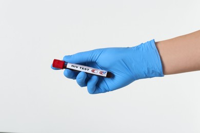 Scientist holding tube with blood sample and label HIV TEST on light background, closeup