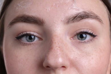 Woman with dry skin on face, macro view