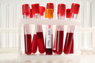 Photo of Tubes with blood samples in rack on white background. STD test