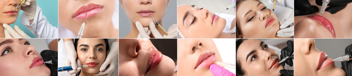 Image of Collage with photos of women during procedures of lip augmentation and permanent makeup, closeup. Banner design