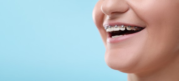 Image of Smiling woman with braces on light blue background, closeup. Banner design with space for text