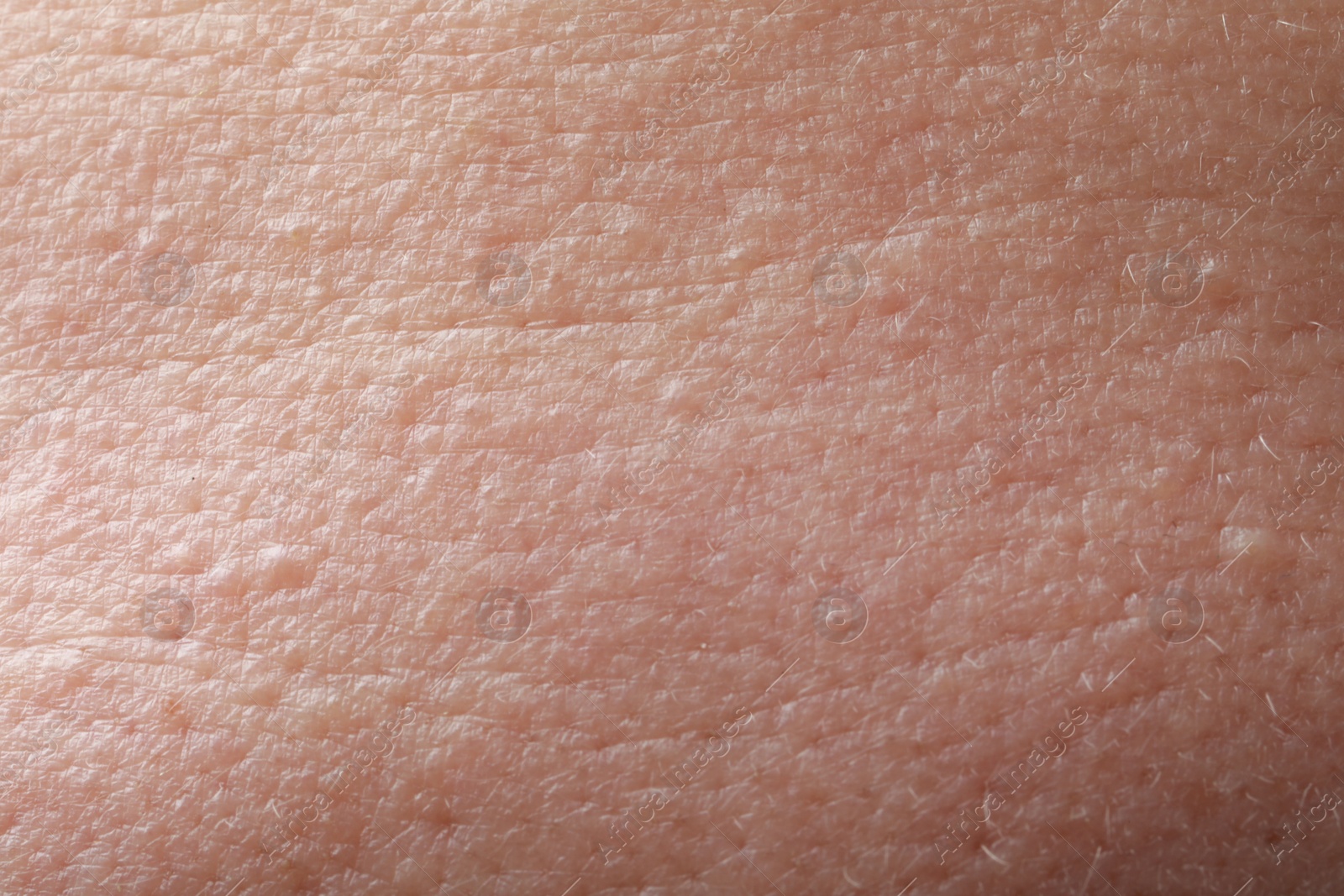 Photo of Closeup view of human skin as background