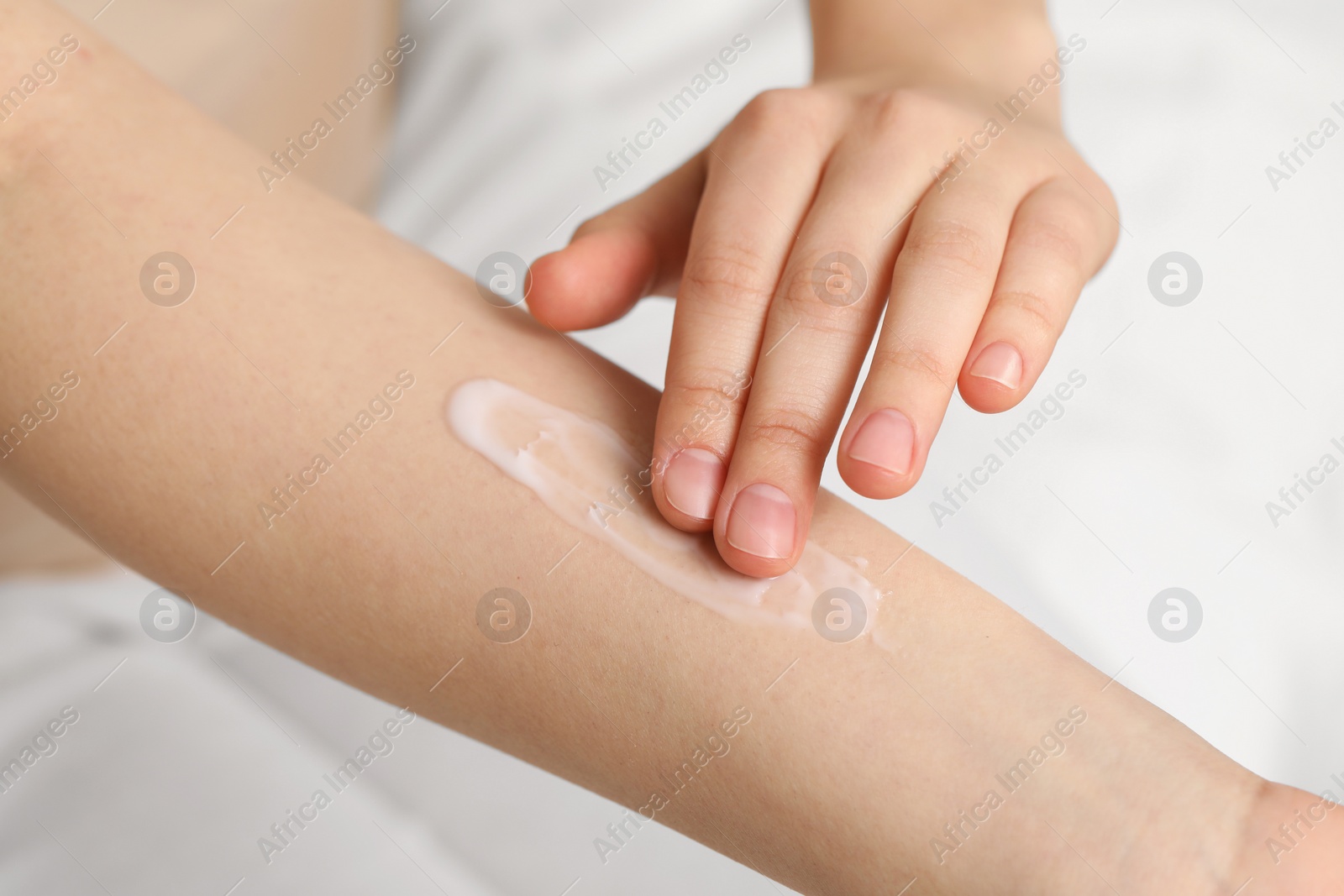 Photo of Young woman with dry skin applying cream onto her arm on bed, closeup