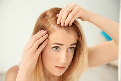 Photo of Young woman with hair loss problem on light background