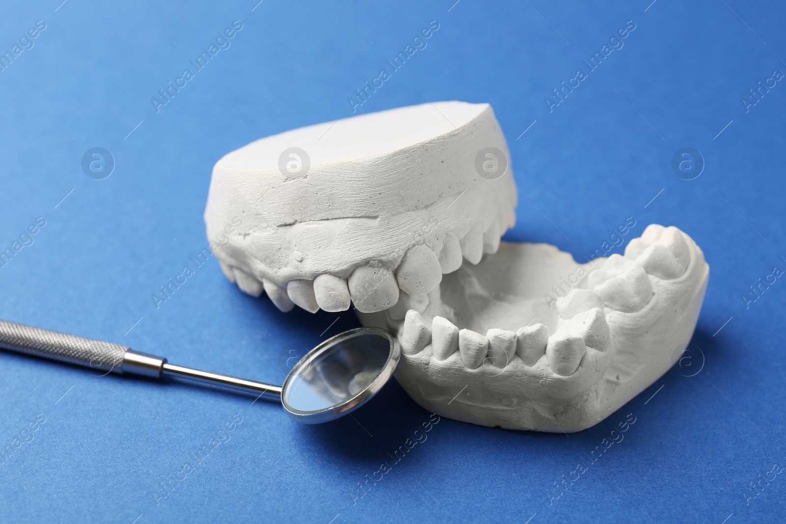 Photo of Dental model with gums and dentist mirror on blue background. Cast of teeth