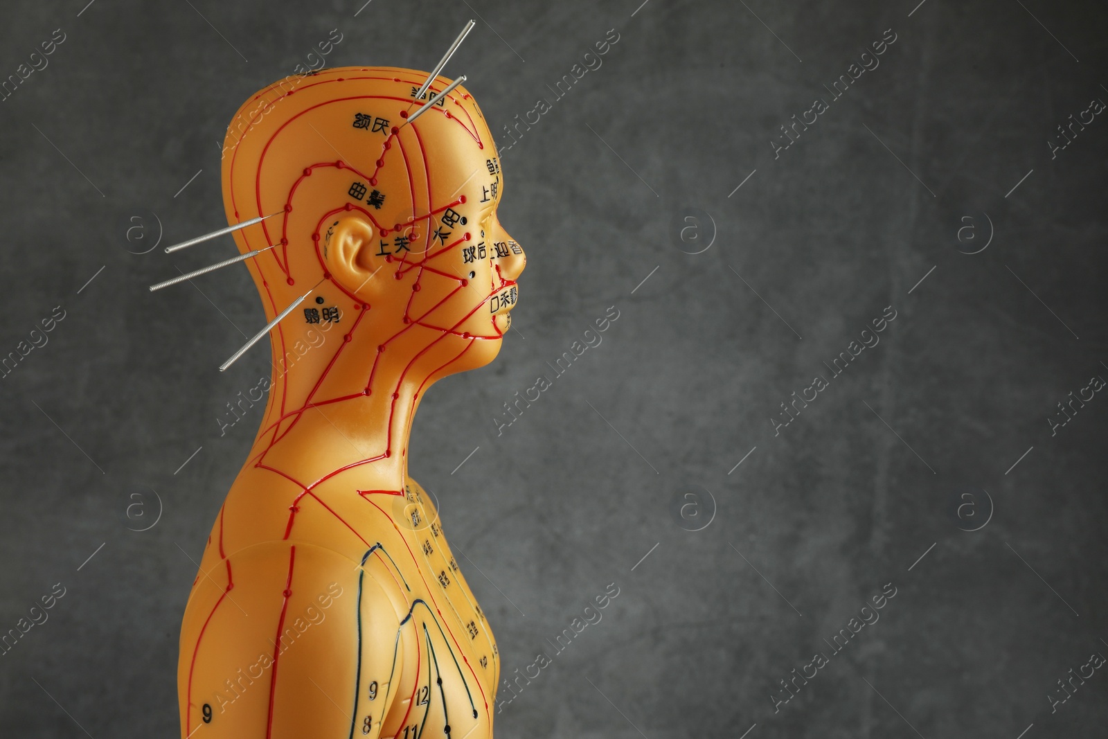 Photo of Acupuncture - alternative medicine. Human model with needles in head against dark grey background, space for text
