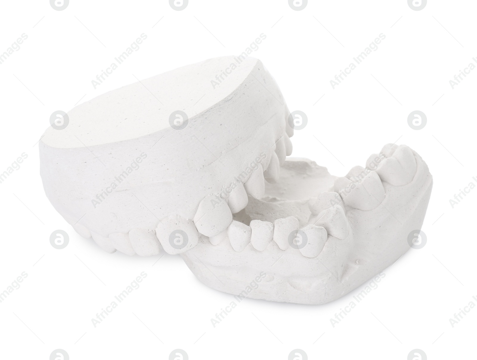 Photo of Dental model with gums isolated on white. Cast of teeth