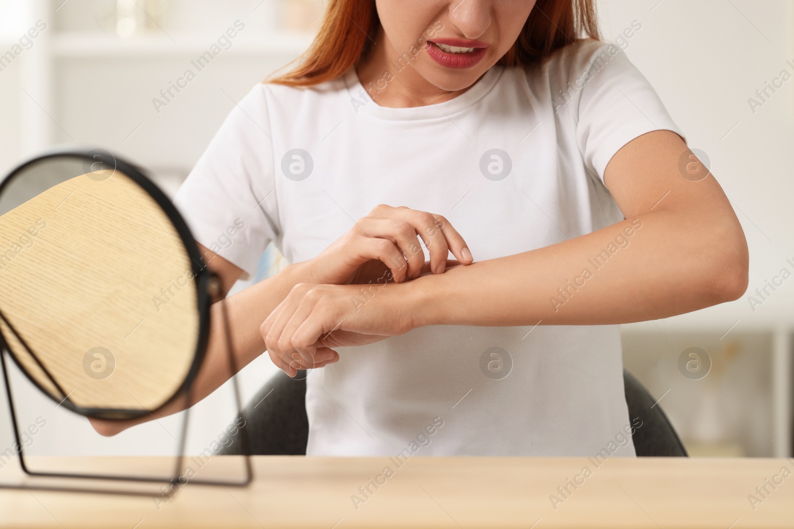 Photo of Suffering from allergy. Young woman scratching her arm indoors, closeup