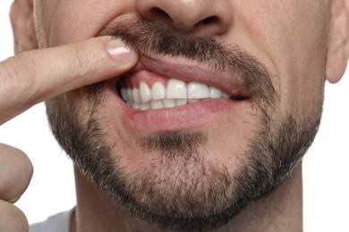 Man showing healthy gums on white background, closeup