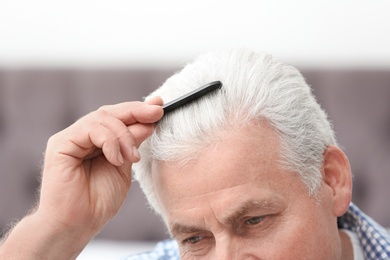 Senior man with hair loss problem indoors, closeup