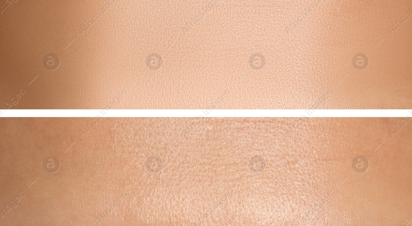 Image of Collage with photos of dry and moisturized skin texture