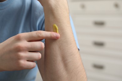 Photo of Man applying yellow ointment onto his arm indoors, closeup
