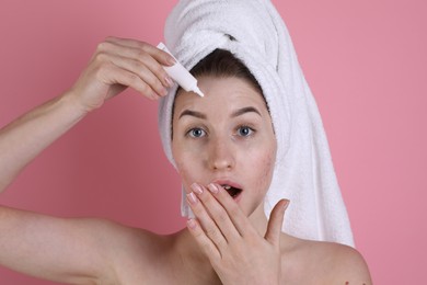 Photo of Emotional young woman with acne problem applying cosmetic product onto her skin on pink background