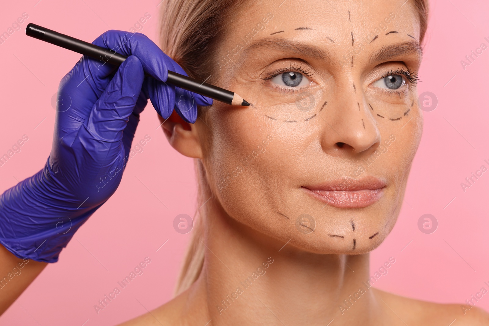 Photo of Doctor with pencil preparing patient for cosmetic surgery operation on pink background, closeup