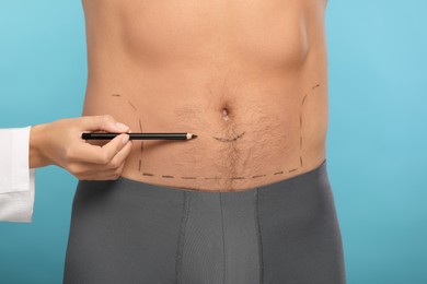 Photo of Doctor with pencil preparing patient for cosmetic surgery operation on light blue background, closeup
