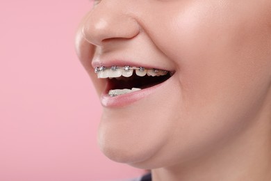 Photo of Smiling woman with dental braces on pink background, closeup. Space for text