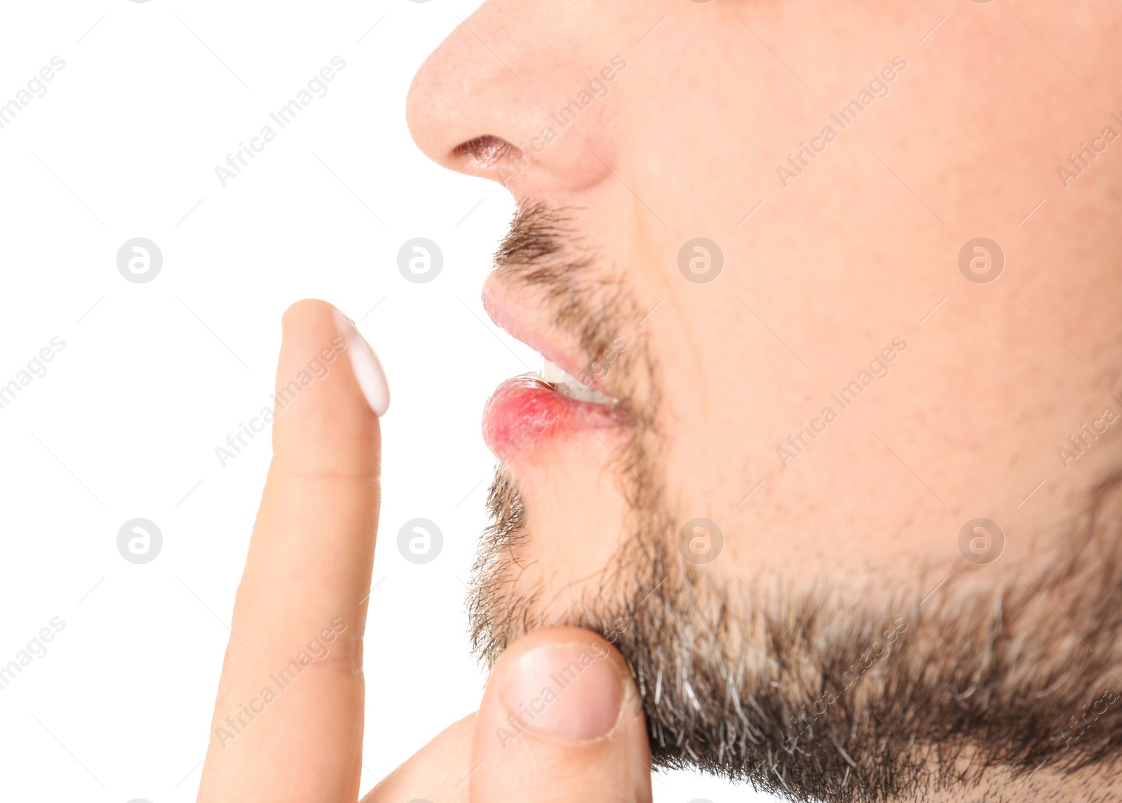 Photo of Man applying cream onto lips on white background, closeup