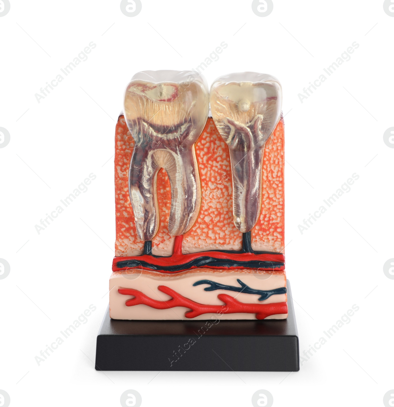 Photo of Educational model of jaw section with teeth isolated on white