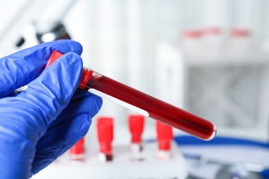 Photo of Scientist holding test tube with blood sample at table, closeup. Virus research