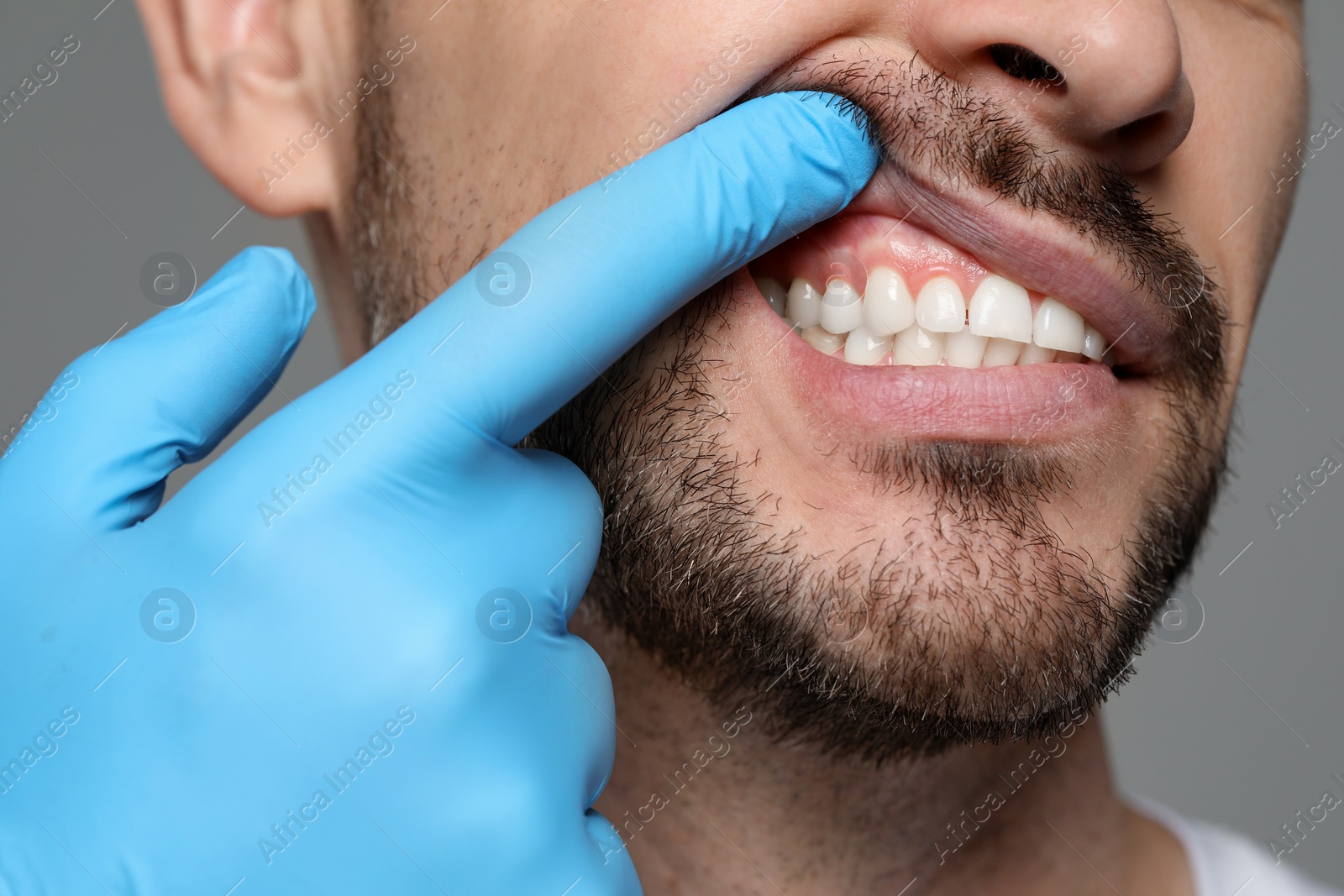 Photo of Man showing healthy gums on gray background, closeup