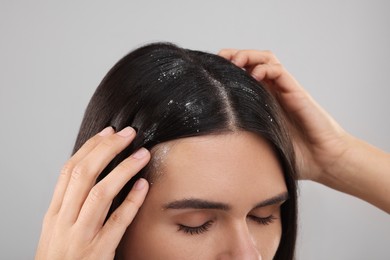 Woman examining her hair and scalp on grey background, closeup. Dandruff problem