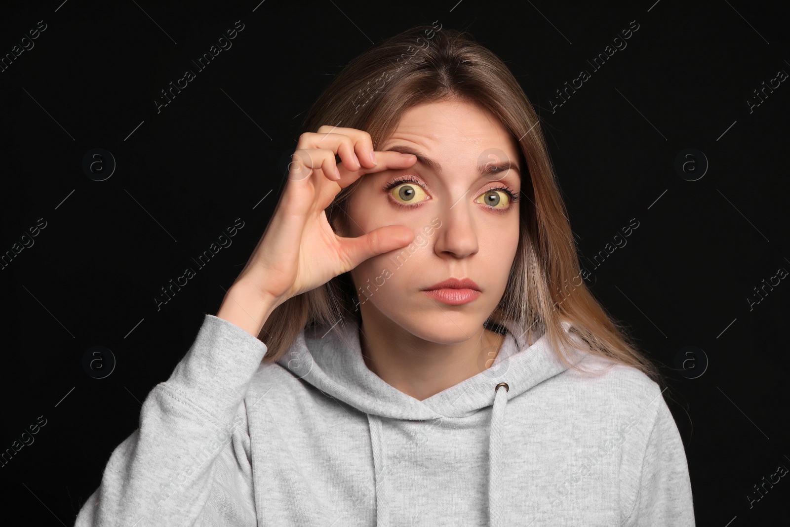 Photo of Woman checking her health condition on black background. Yellow eyes as symptom of problems with liver