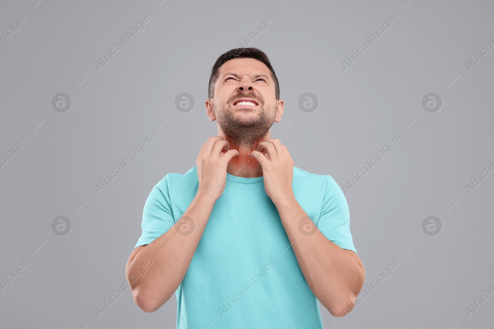 Photo of Allergy symptom. Man scratching his neck on light grey background