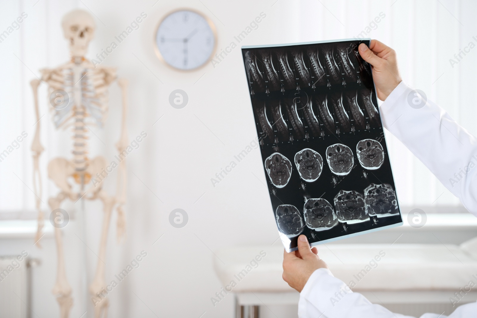 Photo of Orthopedist examining X-ray picture in clinic, closeup