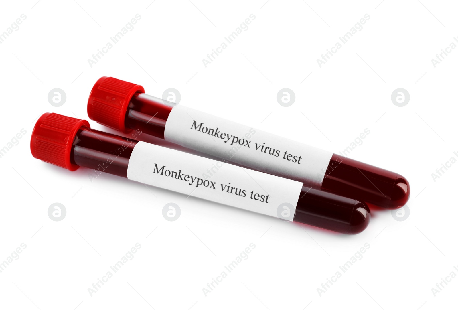 Photo of Monkeypox virus test. Sample tubes with blood on white background