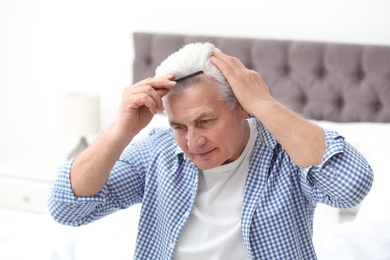 Senior man with hair loss problem indoors