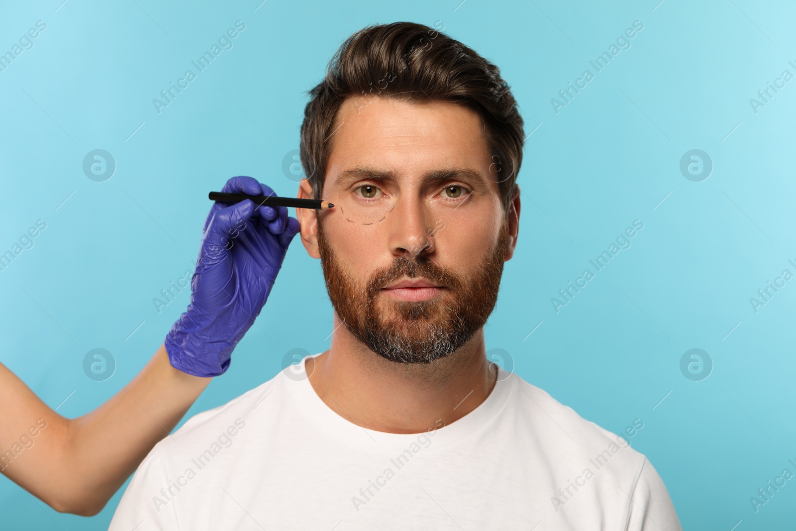 Photo of Doctor with pencil preparing patient for cosmetic surgery operation on light blue background