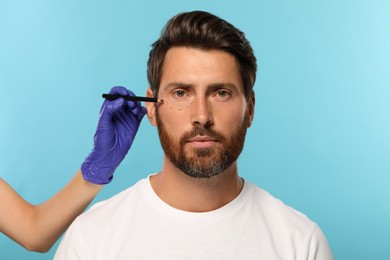 Doctor with pencil preparing patient for cosmetic surgery operation on light blue background