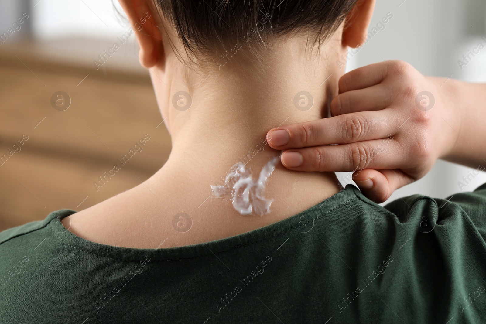 Photo of Woman applying ointment onto her neck indoors, closeup