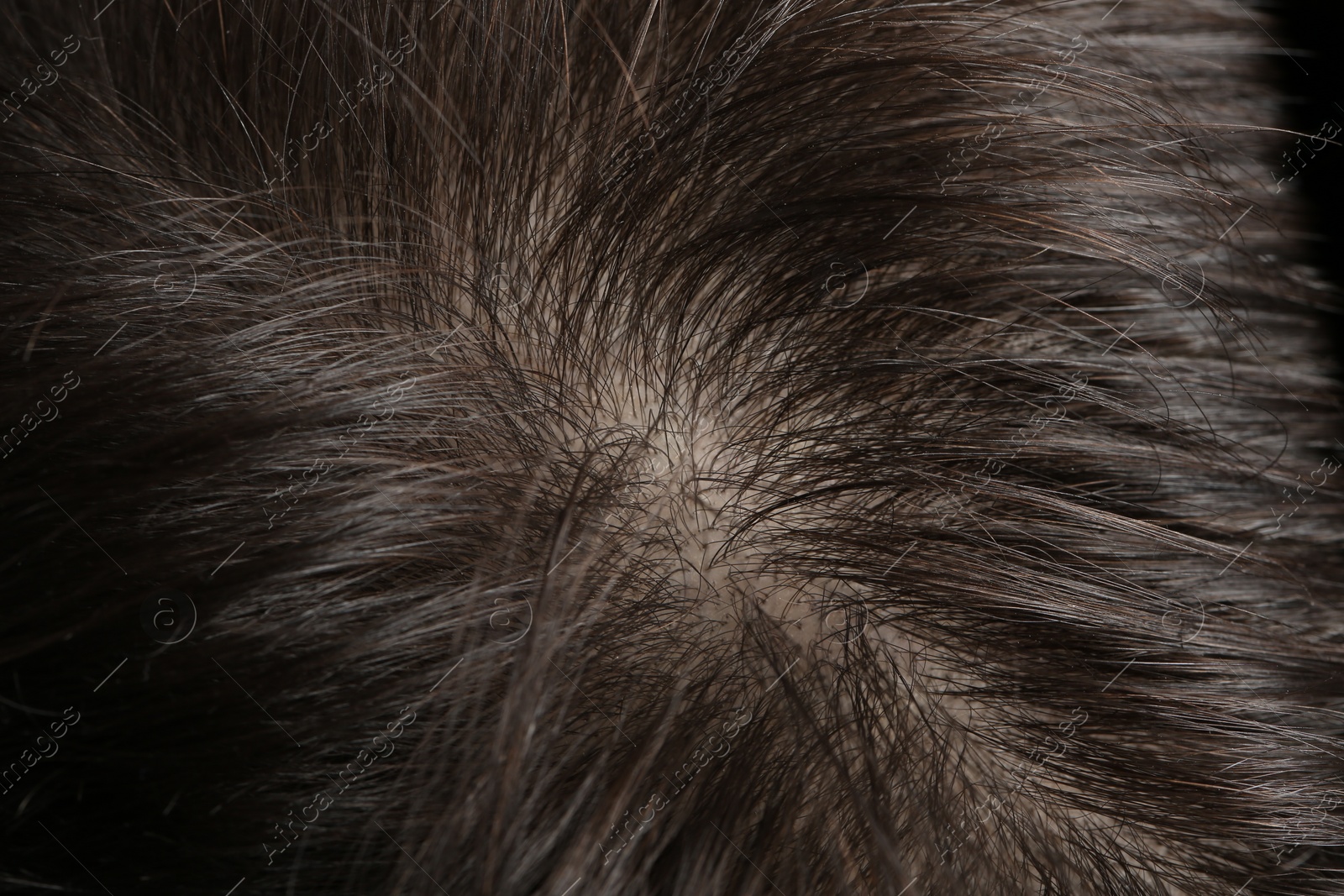 Photo of Man with healthy dark hair, macro view