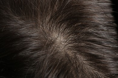 Man with healthy dark hair, macro view