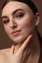 Photo of Portrait of beautiful woman with fake freckles on brown background, closeup
