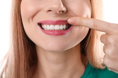 Smiling woman with perfect teeth on white background, closeup