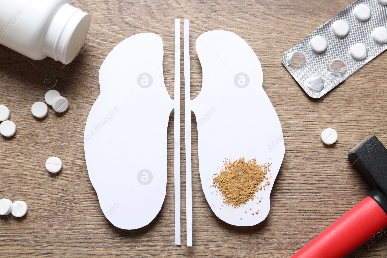 Photo of Paper cutout with sand, pills and hammer on wooden table, flat lay. Kidney stone disease