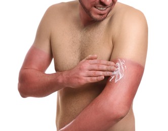 Photo of Man applying cream on sunburn against white background, closeup