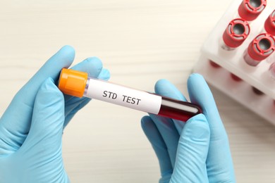Photo of Scientist holding tube with blood sample and label STD Test at white table, top view