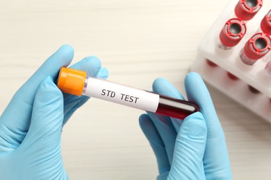 Scientist holding tube with blood sample and label STD Test at white table, top view