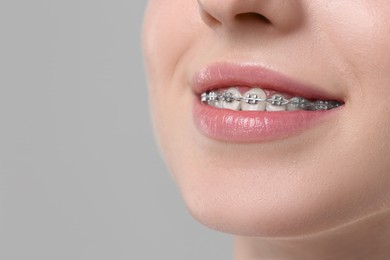 Photo of Smiling woman with dental braces on grey background, closeup. Space for text