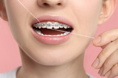 Woman with braces cleaning teeth using dental floss on pink background, closeup