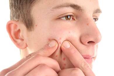 Photo of Young man squeezing acne on white background