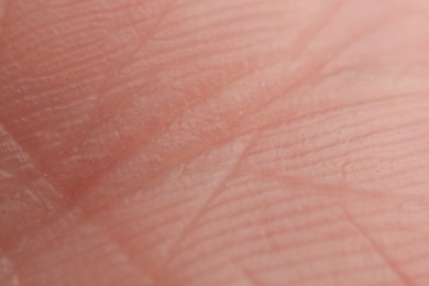 Photo of Texture of dry skin as background, macro view