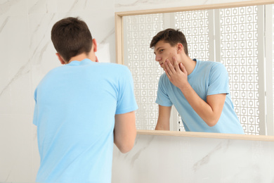 Photo of Teen guy with acne problem near mirror in bathroom