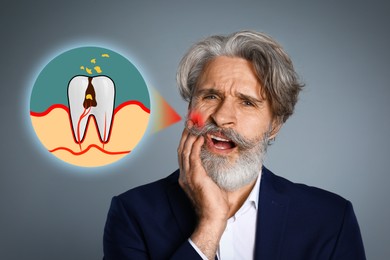 Image of Mature man suffering from toothache on grey background