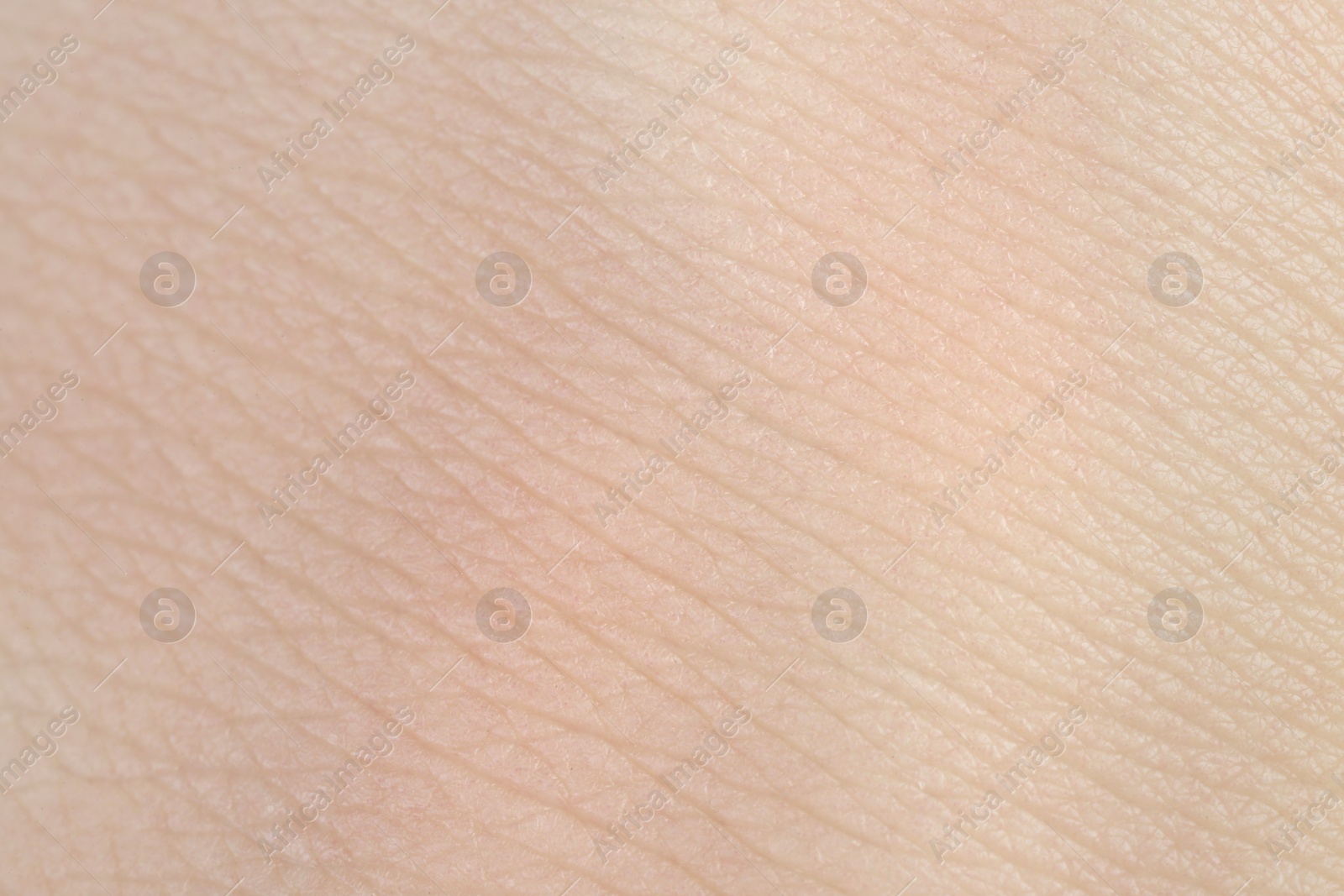 Photo of Texture of healthy skin as background, macro view